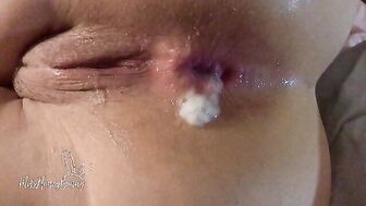 CLOSELY PAINFUL ASSHOLE MADE HIM CREAM PIE ME RAPID