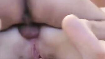 Russian pair anus sex